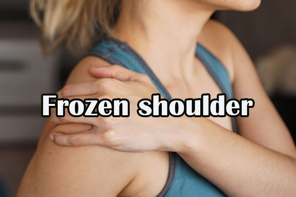 شانه منجمد یا شانه یخ زده
