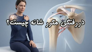 دررفتگی مکرر شانه