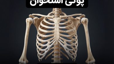 پوکی استخوان