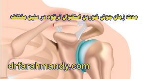 جوش خوردن استخوان ترقوه