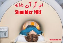 ام آر آی شانه (MRI)