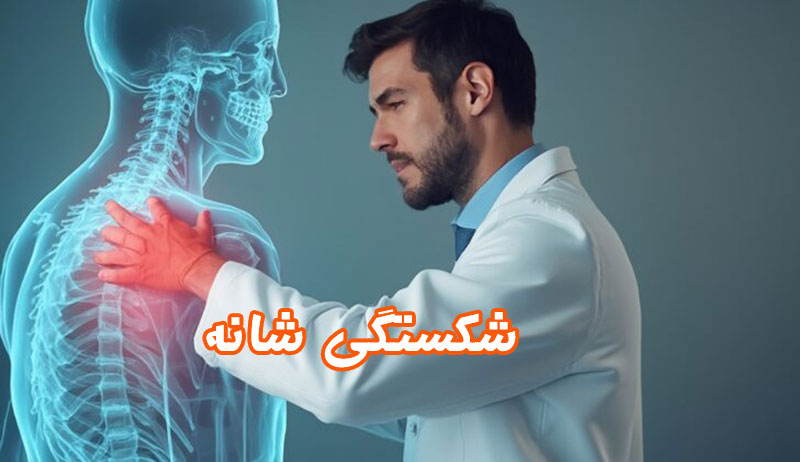 شکستگی-شانه
