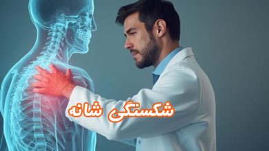 شکستگی-شانه