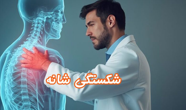 شکستگی-شانه