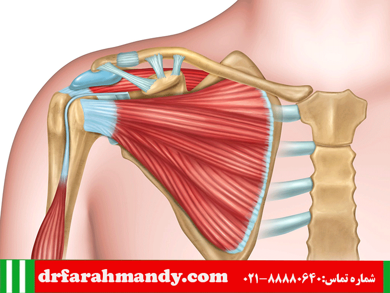 دررفتگی مکرر شانه و پارگی لابروم چیست | انواع دررفتگی و دلایل مکرر دررفتگی و راه درمان