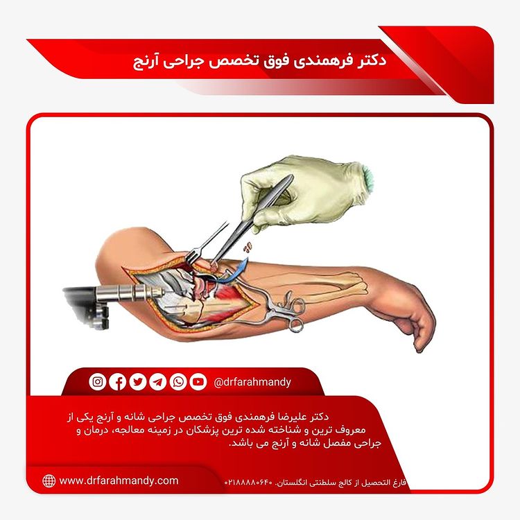 بهترین فوق تخصص جراحی آرنج در ایران