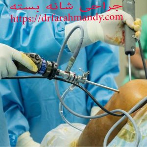 جراحی شانه بسته | دکتر علیرضا فرهمندی